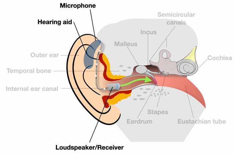 hearing aids essay